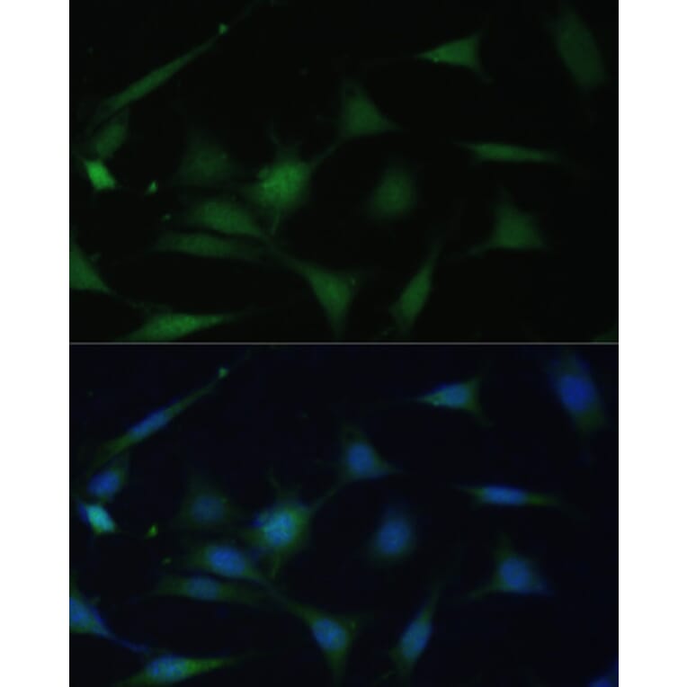 Immunofluorescence - Anti-p38 alpha/MAPK14 Antibody (A89761) - Antibodies.com
