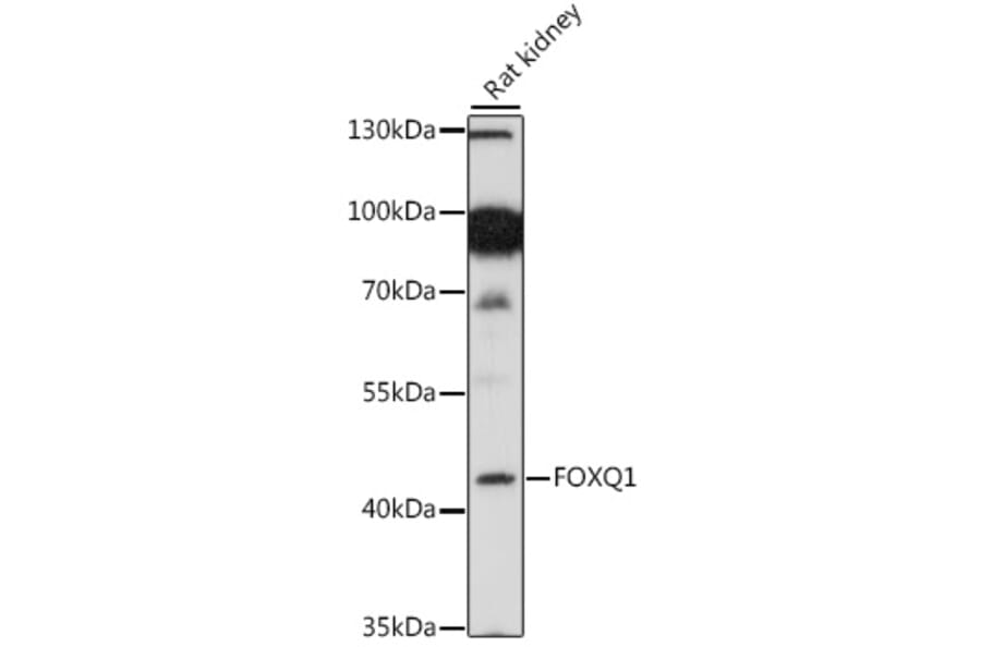 Western Blot - Anti-FOXQ1 Antibody (A89762) - Antibodies.com