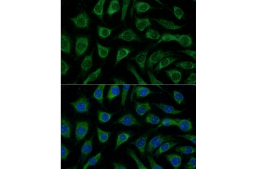 Immunofluorescence - Anti-p38 alpha / MAPK14 Antibody (A89763) - Antibodies.com