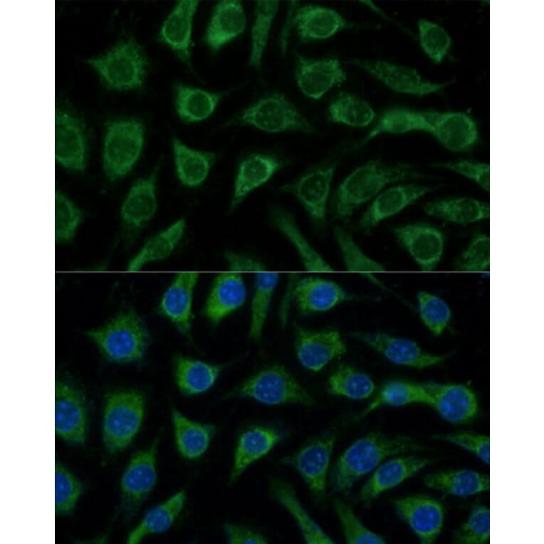 Immunofluorescence - Anti-p38 alpha / MAPK14 Antibody (A89763) - Antibodies.com