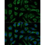 Immunofluorescence - Anti-p38 alpha / MAPK14 Antibody (A89763) - Antibodies.com