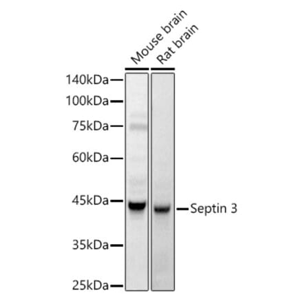 Western Blot - Anti-Septin 3 Antibody (A89764) - Antibodies.com
