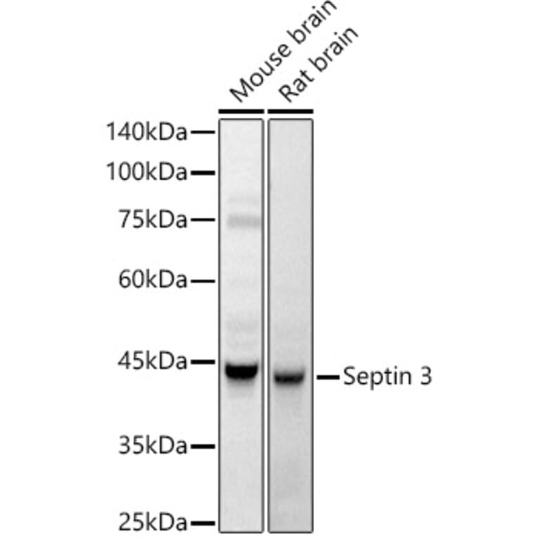 Western Blot - Anti-Septin 3 Antibody (A89764) - Antibodies.com