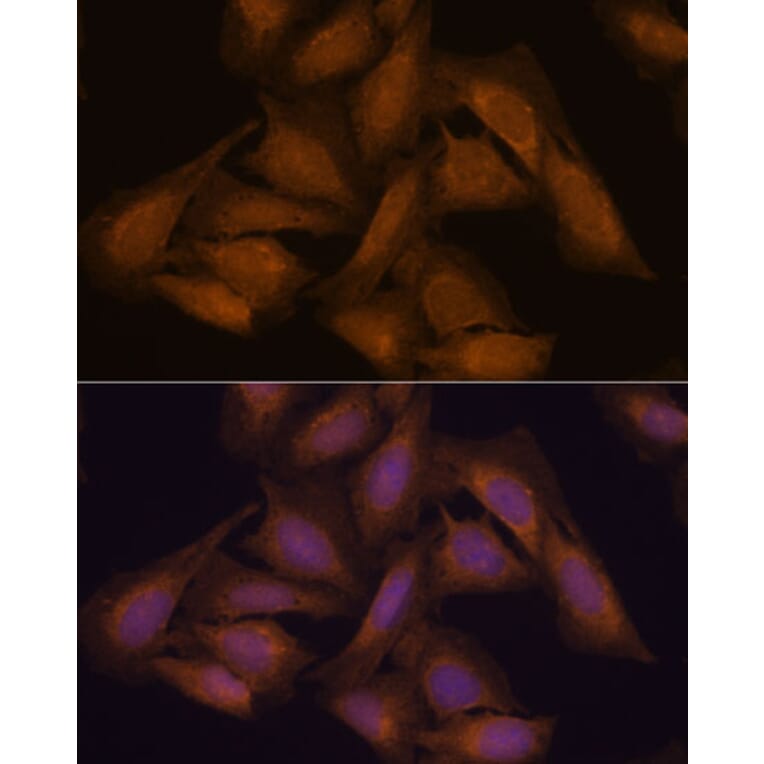 Immunofluorescence - Anti-Septin 3 Antibody (A89764) - Antibodies.com