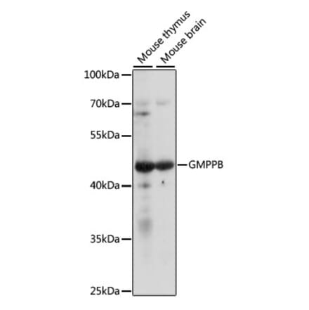 Western Blot - Anti-GMPPB Antibody (A89766) - Antibodies.com