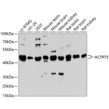 Western Blot - Anti-ACTRT3 Antibody (A89767) - Antibodies.com