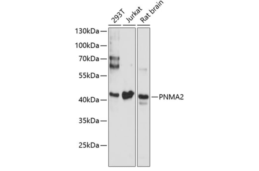 Western Blot - Anti-MA2 Antibody (A89768) - Antibodies.com
