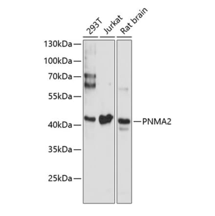 Western Blot - Anti-MA2 Antibody (A89768) - Antibodies.com