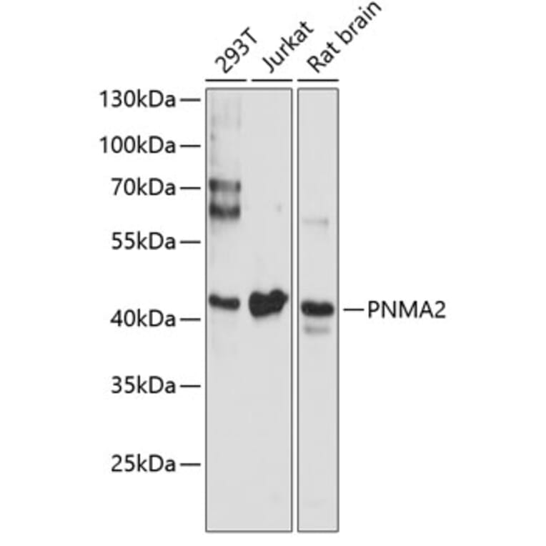 Western Blot - Anti-MA2 Antibody (A89768) - Antibodies.com