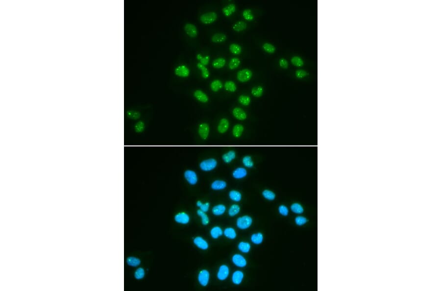 Immunofluorescence - Anti-Bmi1 Antibody (A89769) - Antibodies.com