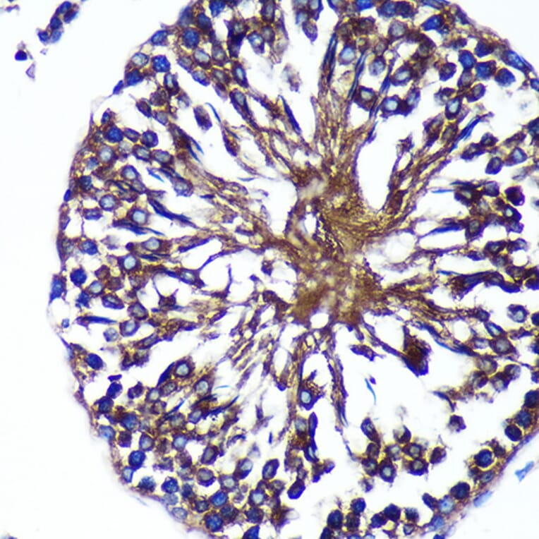 Immunohistochemistry - Anti-Bif-1 Antibody (A89770) - Antibodies.com