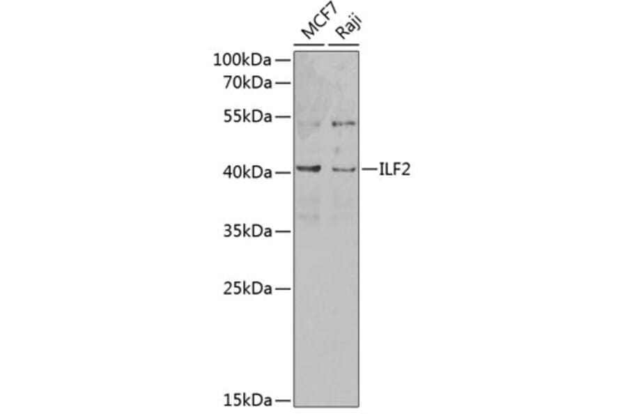 Western Blot - Anti-ILF2/NF45 Antibody (A89771) - Antibodies.com