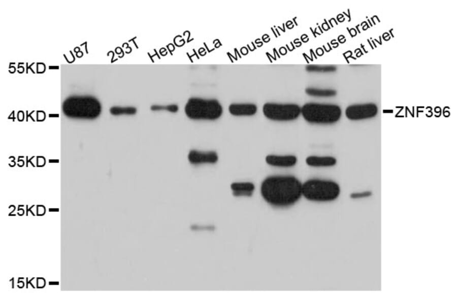 Western Blot - Anti-ZNF396 Antibody (A13836) - Antibodies.com