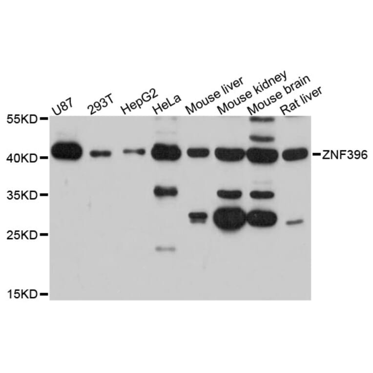 Western Blot - Anti-ZNF396 Antibody (A13836) - Antibodies.com