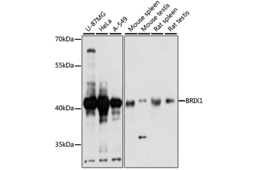 Western Blot - Anti-BRIX1 Antibody (A89775) - Antibodies.com