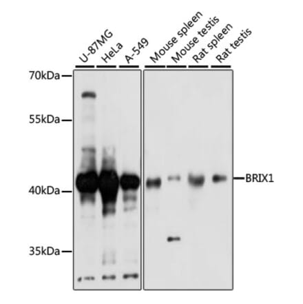Western Blot - Anti-BRIX1 Antibody (A89775) - Antibodies.com