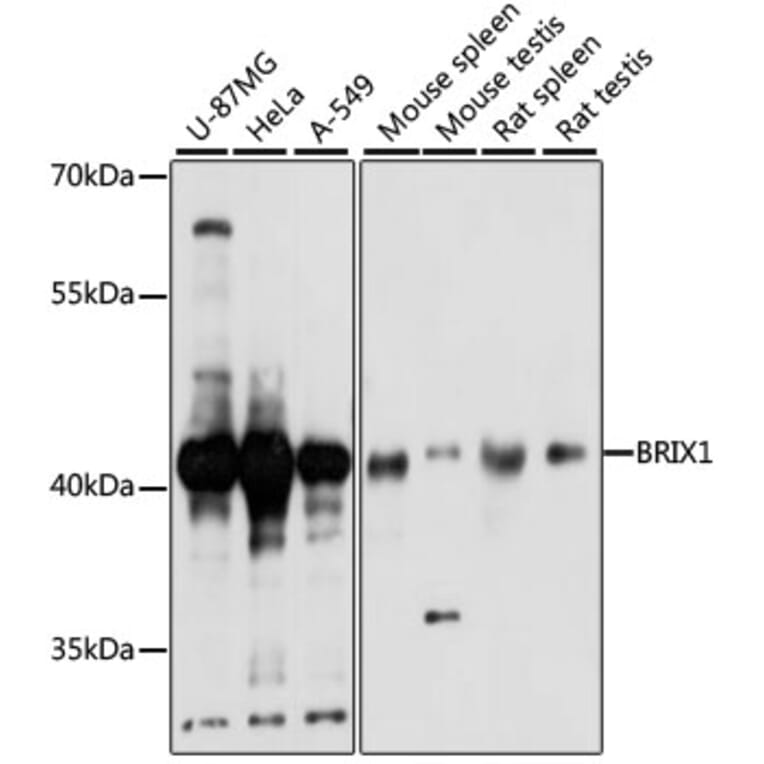 Western Blot - Anti-BRIX1 Antibody (A89775) - Antibodies.com