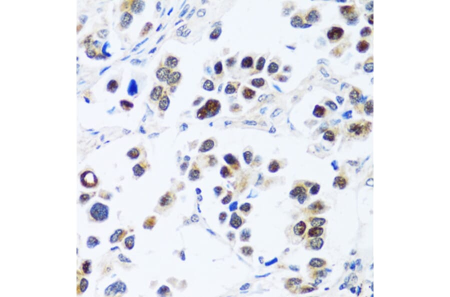 Immunohistochemistry - Anti-BRIX1 Antibody (A89775) - Antibodies.com