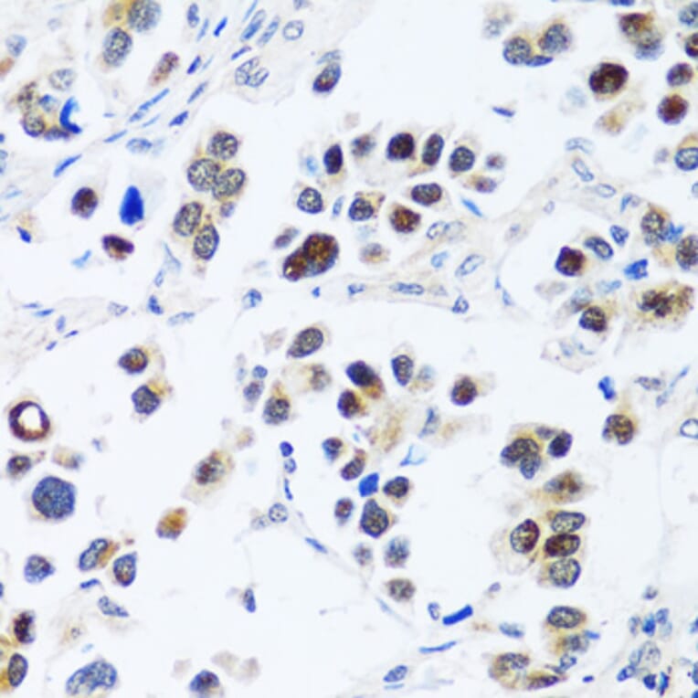 Immunohistochemistry - Anti-BRIX1 Antibody (A89775) - Antibodies.com