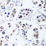 Immunohistochemistry - Anti-BRIX1 Antibody (A89775) - Antibodies.com