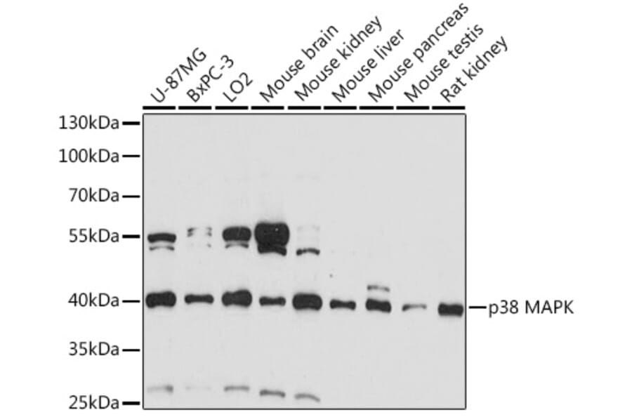 Western Blot - Anti-p38 alpha / MAPK14 Antibody (A89776) - Antibodies.com