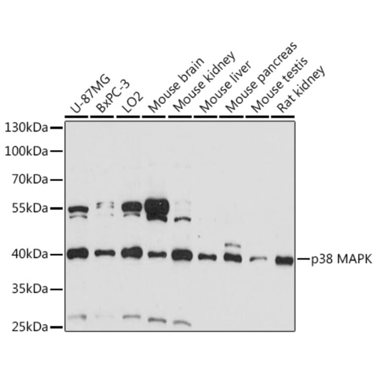 Western Blot - Anti-p38 alpha / MAPK14 Antibody (A89776) - Antibodies.com
