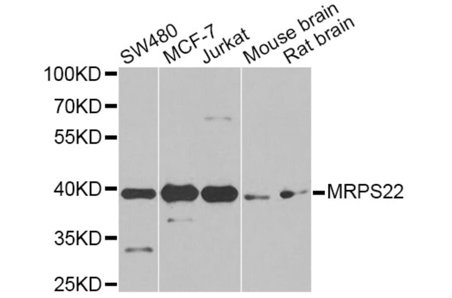 Western Blot - Anti-MRPS22 Antibody (A12597) - Antibodies.com