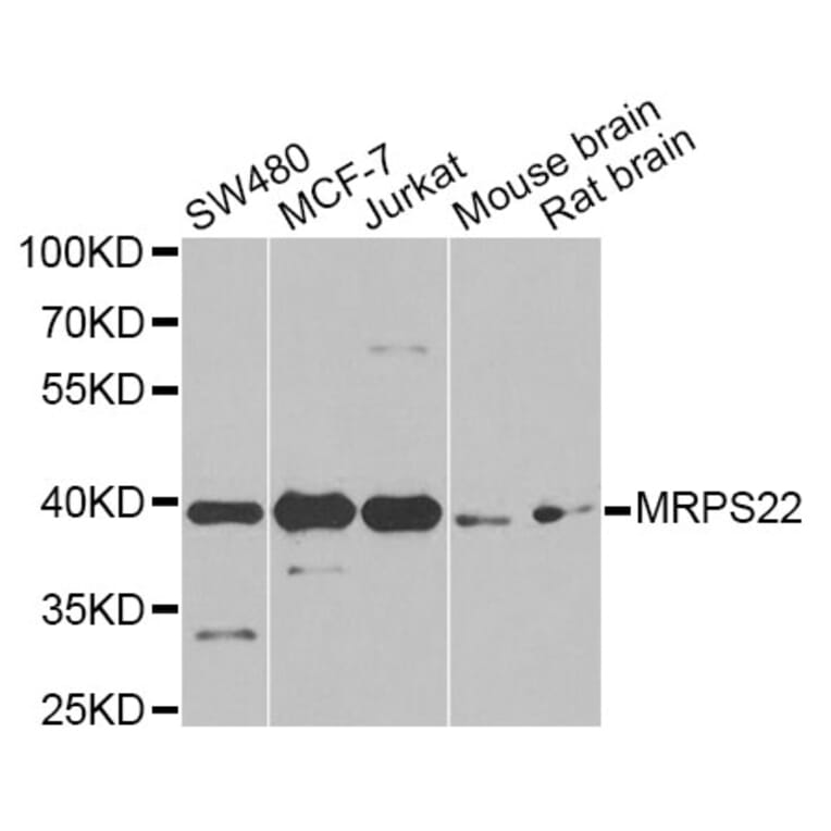 Western Blot - Anti-MRPS22 Antibody (A12597) - Antibodies.com