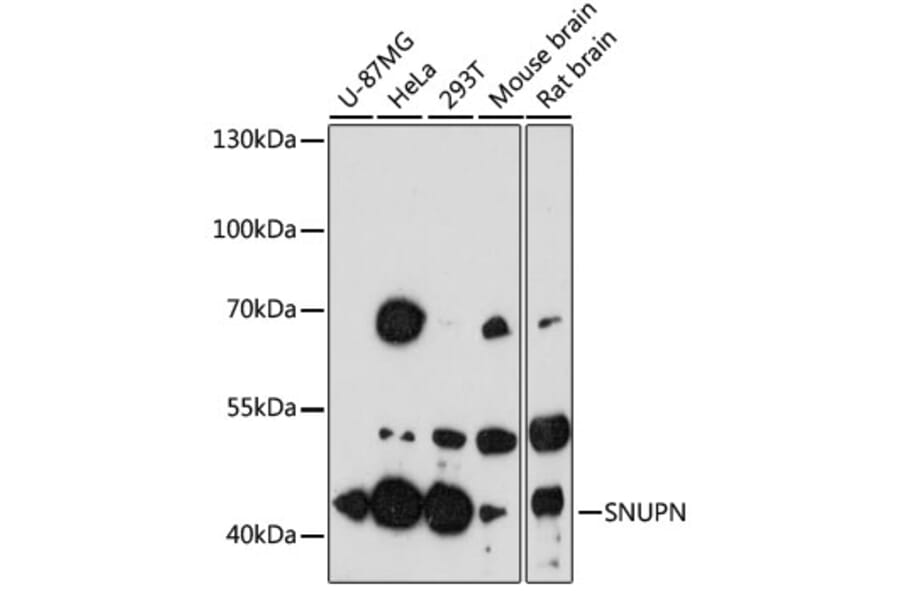 Western Blot - Anti-SNUPN Antibody (A13736) - Antibodies.com