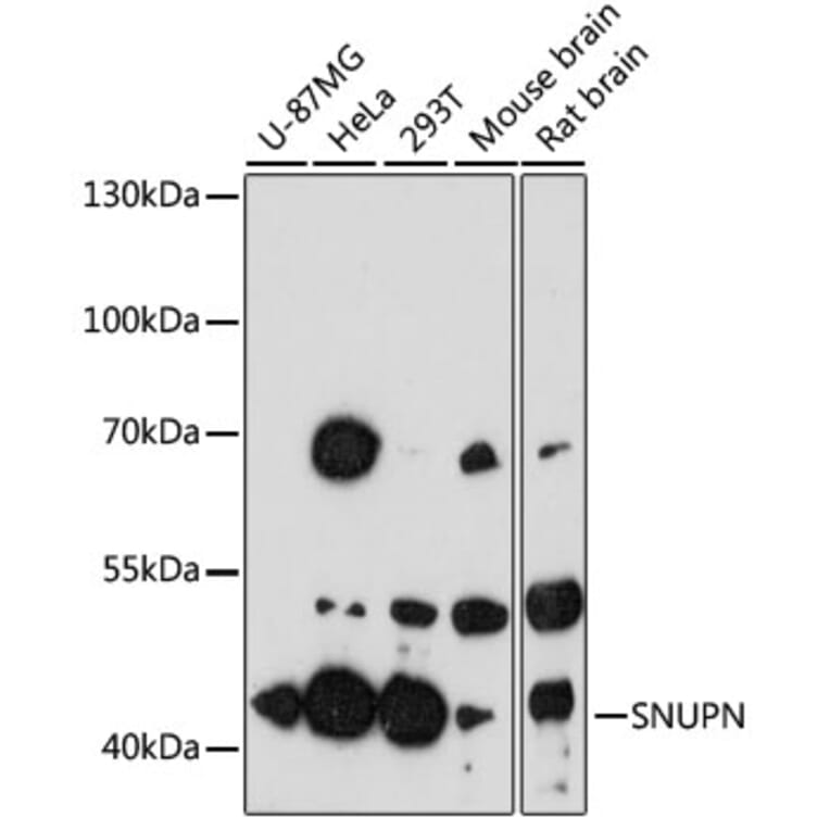 Western Blot - Anti-SNUPN Antibody (A13736) - Antibodies.com