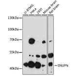 Western Blot - Anti-SNUPN Antibody (A13736) - Antibodies.com