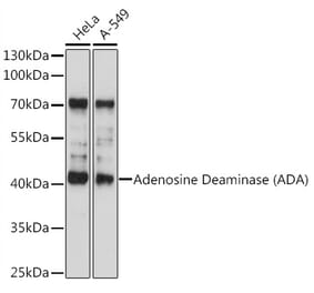 Western Blot - Anti-ADA Antibody (A89779) - Antibodies.com