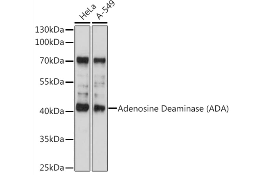 Western Blot - Anti-ADA Antibody (A89779) - Antibodies.com