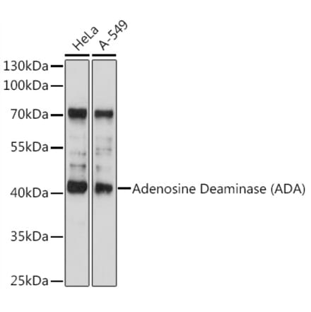 Western Blot - Anti-ADA Antibody (A89779) - Antibodies.com