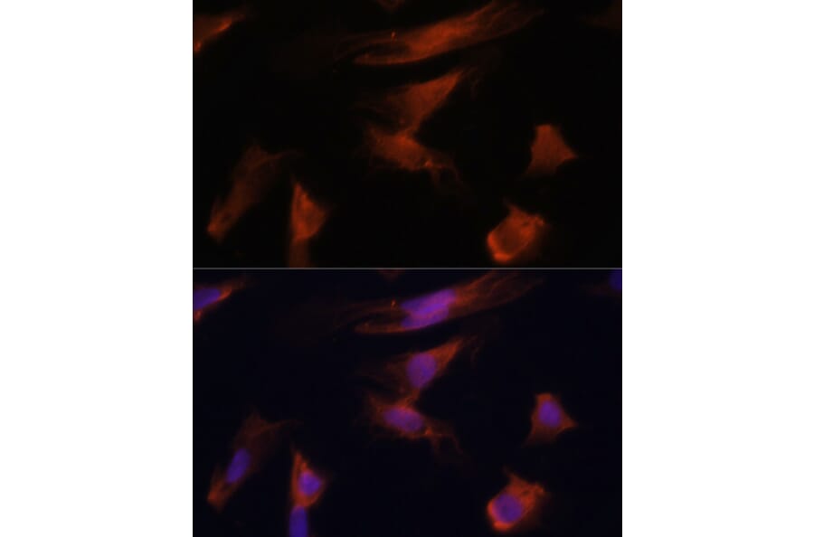 Immunofluorescence - Anti-ADA Antibody (A89779) - Antibodies.com