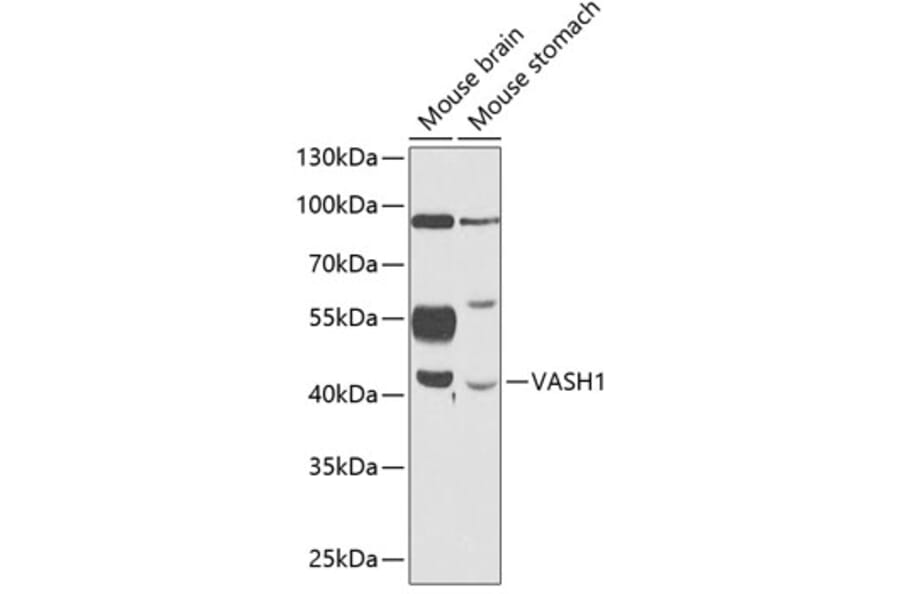 Western Blot - Anti-VASH1 Antibody (A89780) - Antibodies.com