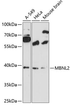 Western blot analysis of extracts of various cell lines, using Anti-MBNL2 Antibody (A12838) at 1:3000 dilution.
Secondary antibody: Goat Anti-Rabbit IgG (H+L) (HRP) (AS014) at 1:10,000 dilution.
Lysates / proteins: 25µg per lane.
Blocking buffer: 3% non-fat dry milk in TBST.
Detection: ECL Basic Kit (RM00020).
Exposure time: 90s.