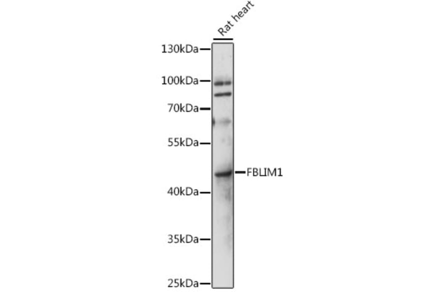 Western Blot - Anti-Migfilin Antibody (A89783) - Antibodies.com