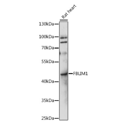 Western Blot - Anti-Migfilin Antibody (A89783) - Antibodies.com