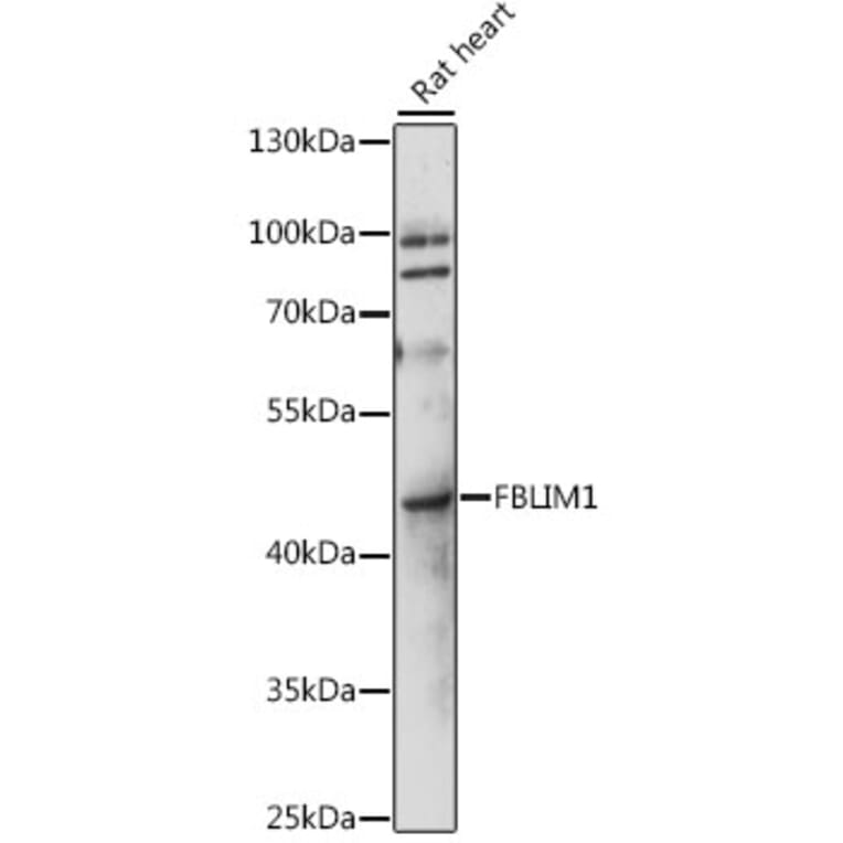 Western Blot - Anti-Migfilin Antibody (A89783) - Antibodies.com