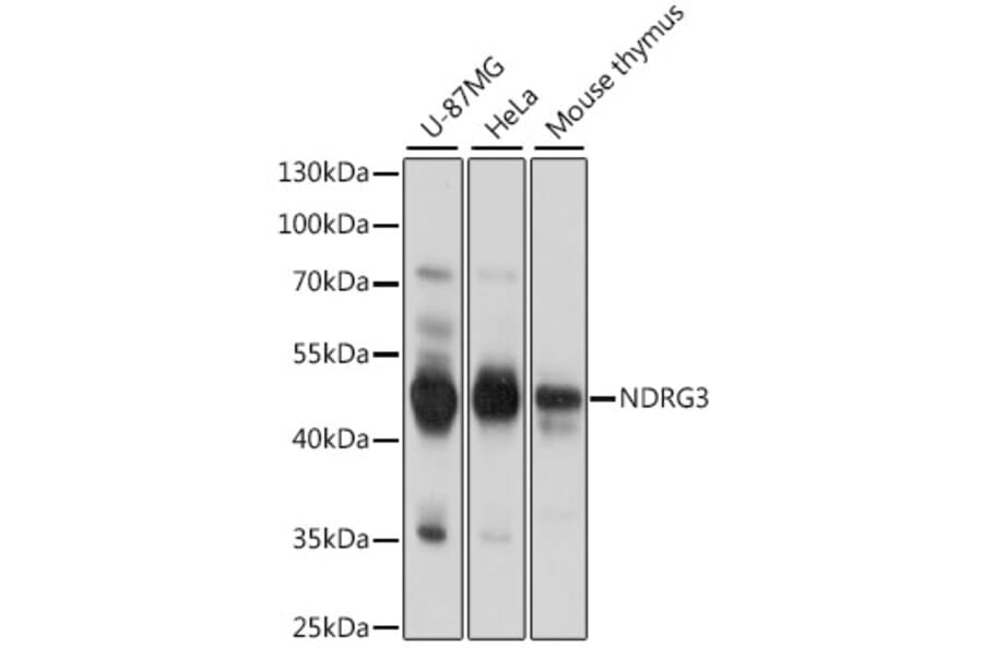 Western Blot - Anti-NDRG3 Antibody (A89784) - Antibodies.com