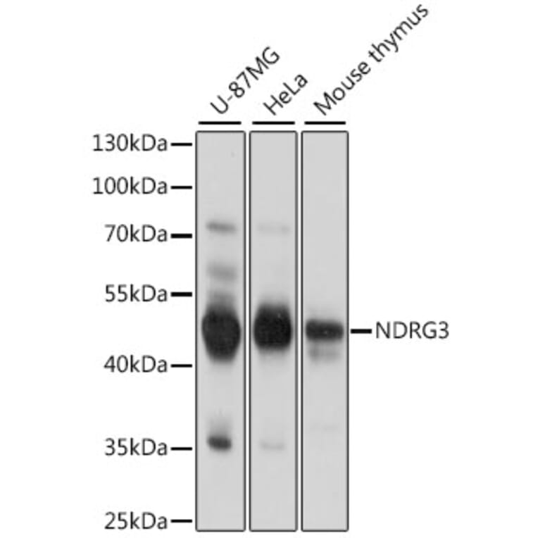 Western Blot - Anti-NDRG3 Antibody (A89784) - Antibodies.com