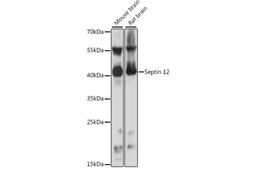 Western Blot - Anti-SEPT12 Antibody (A89785) - Antibodies.com