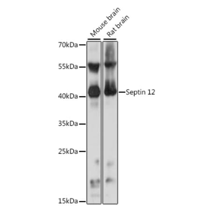 Western Blot - Anti-SEPT12 Antibody (A89785) - Antibodies.com