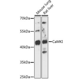 Western Blot - Anti-CaMKI Antibody (A89786) - Antibodies.com