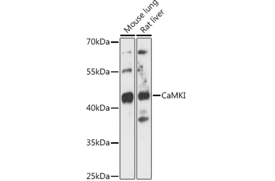 Western Blot - Anti-CaMKI Antibody (A89786) - Antibodies.com