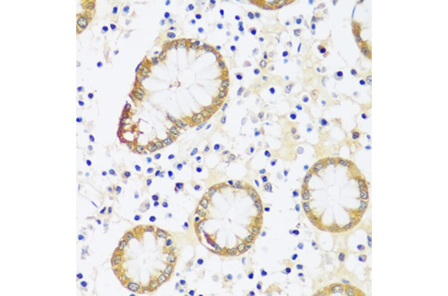 Immunohistochemistry - Anti-CaMKI Antibody (A89786) - Antibodies.com