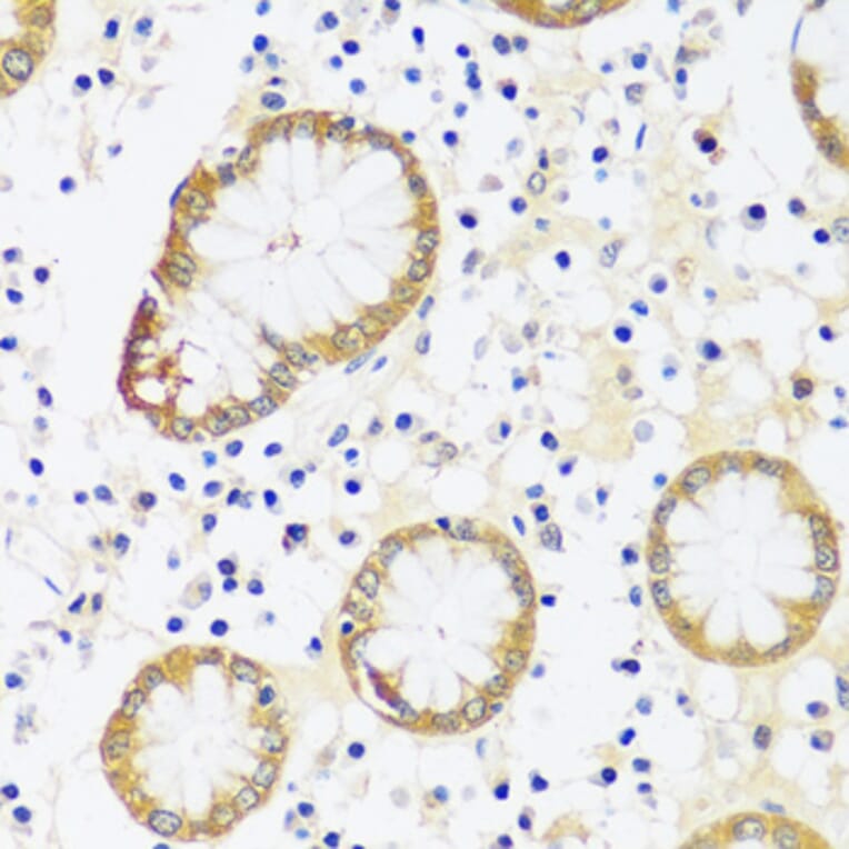 Immunohistochemistry - Anti-CaMKI Antibody (A89786) - Antibodies.com