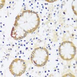 Immunohistochemistry - Anti-CaMKI Antibody (A89786) - Antibodies.com