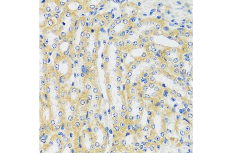 Immunohistochemistry - Anti-CaMKI Antibody (A89786) - Antibodies.com